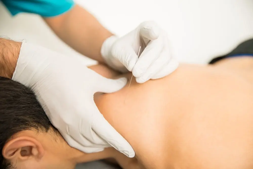 Best Ways to Ease Pain Using Dry Needling